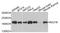 Bromodomain Adjacent To Zinc Finger Domain 1B antibody, A9851, ABclonal Technology, Western Blot image 