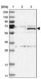 Zinc Finger Protein 189 antibody, PA5-57073, Invitrogen Antibodies, Western Blot image 
