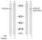 Phospholipase C Gamma 2 antibody, GTX78962, GeneTex, Western Blot image 