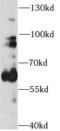 Tyrosine Hydroxylase antibody, FNab08655, FineTest, Western Blot image 