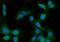 Cytochrome P450 Family 51 Subfamily A Member 1 antibody, A04032-1, Boster Biological Technology, Immunofluorescence image 