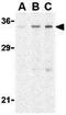 C1q And TNF Related 4 antibody, GTX85503, GeneTex, Western Blot image 