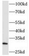 Phytanoyl-CoA Dioxygenase Domain Containing 1 antibody, FNab06412, FineTest, Western Blot image 