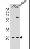 Interleukin 12B antibody, LS-C165172, Lifespan Biosciences, Western Blot image 