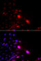 Damage Specific DNA Binding Protein 2 antibody, 18-343, ProSci, Immunofluorescence image 