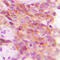 Proteasome 26S Subunit, Non-ATPase 12 antibody, LS-C352732, Lifespan Biosciences, Immunohistochemistry paraffin image 