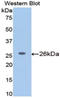 Beta-N-Acetylglucosaminidase antibody, LS-C299435, Lifespan Biosciences, Western Blot image 