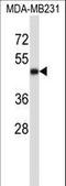 CD1a Molecule antibody, LS-C168517, Lifespan Biosciences, Western Blot image 