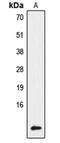 NDUFA4 Mitochondrial Complex Associated antibody, GTX56160, GeneTex, Western Blot image 