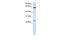 Transmembrane Protein 138 antibody, GTX46339, GeneTex, Western Blot image 