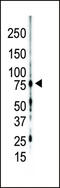 Protein kinase C gamma type antibody, 62-595, ProSci, Western Blot image 