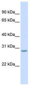 Scratch Family Transcriptional Repressor 2 antibody, TA339781, Origene, Western Blot image 