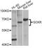 Glucokinase regulatory protein antibody, A5678, ABclonal Technology, Western Blot image 