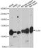 Toll Like Receptor 8 antibody, LS-C747976, Lifespan Biosciences, Western Blot image 