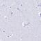 Uromodulin antibody, NBP2-33730, Novus Biologicals, Immunohistochemistry paraffin image 