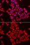 ST3 Beta-Galactoside Alpha-2,3-Sialyltransferase 3 antibody, GTX33520, GeneTex, Immunofluorescence image 