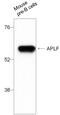 Aprataxin And PNKP Like Factor antibody, PA5-39776, Invitrogen Antibodies, Western Blot image 