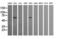 Chaperonin Containing TCP1 Subunit 8 Like 2 antibody, LS-C174263, Lifespan Biosciences, Western Blot image 