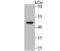 C-X-C Motif Chemokine Receptor 5 antibody, NBP2-75460, Novus Biologicals, Western Blot image 