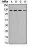 Sterol Regulatory Element Binding Transcription Factor 1 antibody, orb315711, Biorbyt, Western Blot image 