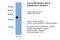 Beta ig-h3 antibody, 29-973, ProSci, Western Blot image 