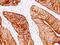 Keratin 8 antibody, GTX34670, GeneTex, Immunohistochemistry paraffin image 