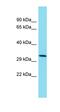 Transmembrane Protein 241 antibody, orb326839, Biorbyt, Western Blot image 