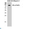 AXL Receptor Tyrosine Kinase antibody, LS-C813333, Lifespan Biosciences, Immunohistochemistry paraffin image 