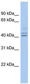 Protein Interacting With Cyclin A1 antibody, TA338860, Origene, Western Blot image 