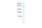 Transcription Factor Dp-1 antibody, 31-194, ProSci, Enzyme Linked Immunosorbent Assay image 