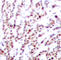 Activating Transcription Factor 2 antibody, AP0308, ABclonal Technology, Immunohistochemistry paraffin image 