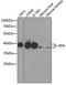 XPA, DNA Damage Recognition And Repair Factor antibody, A1626, ABclonal Technology, Western Blot image 