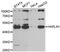 Hyaluronan And Proteoglycan Link Protein 1 antibody, abx005074, Abbexa, Western Blot image 