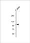 Laeverin antibody, PA5-49459, Invitrogen Antibodies, Western Blot image 