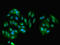 Glycine N-Methyltransferase antibody, LS-C395988, Lifespan Biosciences, Immunofluorescence image 