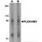 Pleckstrin Homology Domain Containing M3 antibody, MBS151324, MyBioSource, Western Blot image 