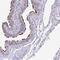 Maestro Heat Like Repeat Family Member 8 antibody, PA5-63836, Invitrogen Antibodies, Immunohistochemistry paraffin image 