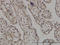 Structural Maintenance Of Chromosomes 6 antibody, LS-C133814, Lifespan Biosciences, Immunohistochemistry paraffin image 