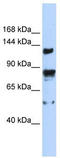 Transient Receptor Potential Cation Channel Subfamily M Member 4 antibody, TA338581, Origene, Western Blot image 
