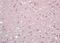 Iroquois Homeobox 1 antibody, orb157707, Biorbyt, Immunohistochemistry paraffin image 