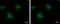 Protein Tyrosine Kinase 7 (Inactive) antibody, GTX113816, GeneTex, Immunofluorescence image 