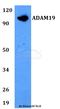 ADAM Metallopeptidase Domain 19 antibody, LS-C411897, Lifespan Biosciences, Western Blot image 