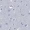 Transmembrane Protein 72 antibody, PA5-58966, Invitrogen Antibodies, Immunohistochemistry frozen image 