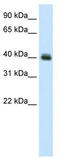 Pseudouridine Synthase 1 antibody, TA342335, Origene, Western Blot image 