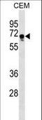 Fem-1 Homolog C antibody, LS-C159640, Lifespan Biosciences, Western Blot image 