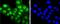Protein Kinase C Alpha antibody, NBP2-66799, Novus Biologicals, Immunofluorescence image 