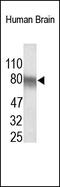 ADAM Metallopeptidase With Thrombospondin Type 1 Motif 4 antibody, 251975, Abbiotec, Western Blot image 