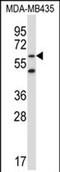Zinc Finger Protein 479 antibody, PA5-71857, Invitrogen Antibodies, Western Blot image 