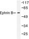 Ephrin B1 antibody, LS-C176277, Lifespan Biosciences, Western Blot image 