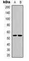 Cholinergic Receptor Nicotinic Alpha 9 Subunit antibody, orb339090, Biorbyt, Western Blot image 